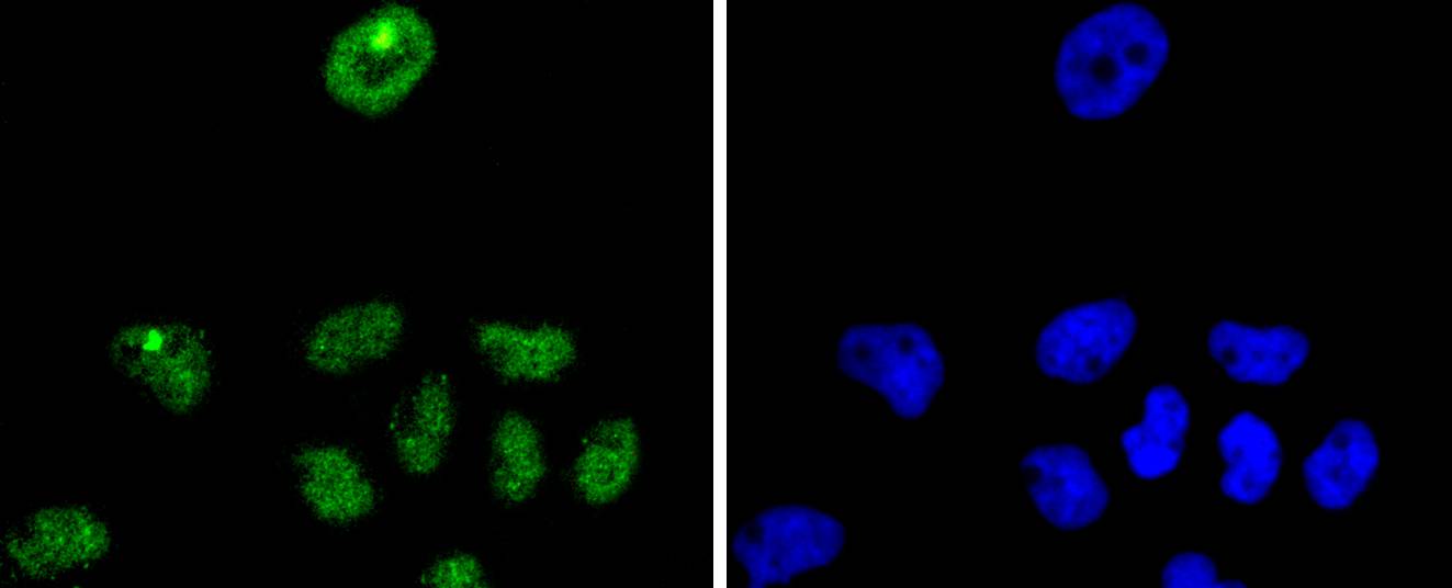 p27 KIP 1 Rabbit mAb