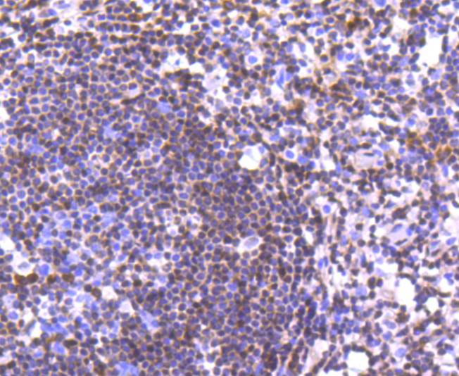 p27 KIP 1 Rabbit mAb