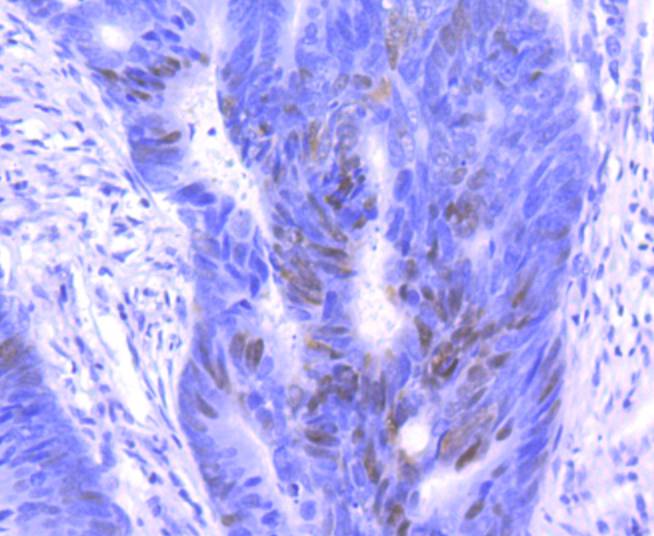 p27 KIP 1 Rabbit mAb