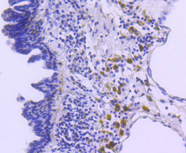 p27 KIP 1 Rabbit mAb