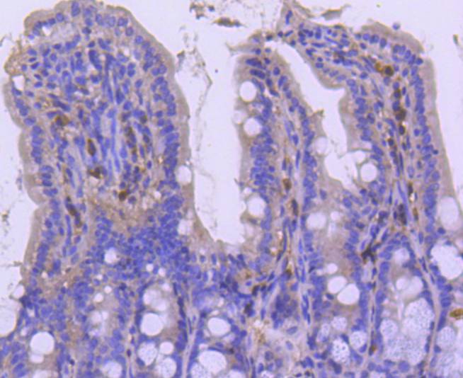 p27 KIP 1 Rabbit mAb