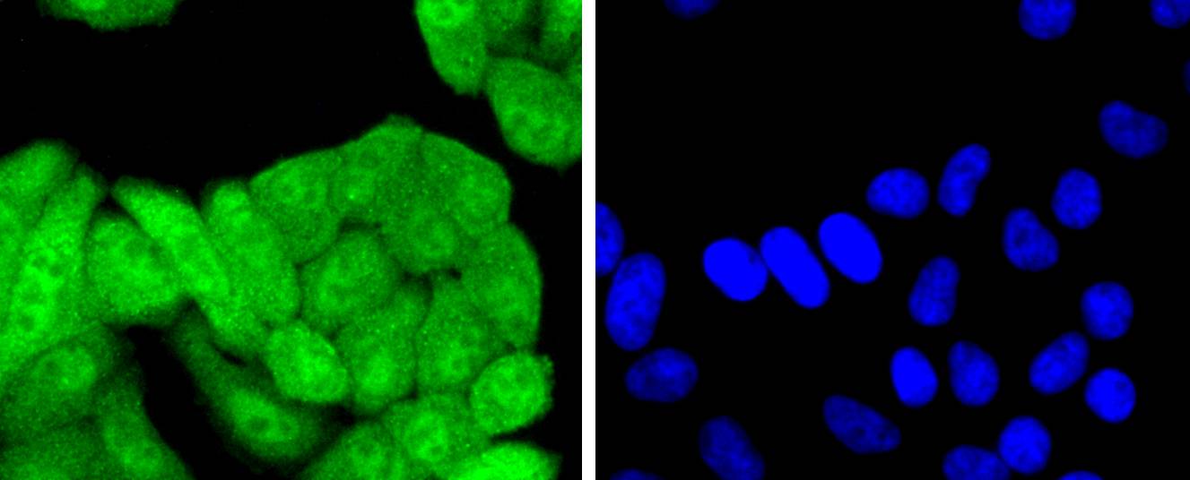 p16INK4A Rabbit mAb