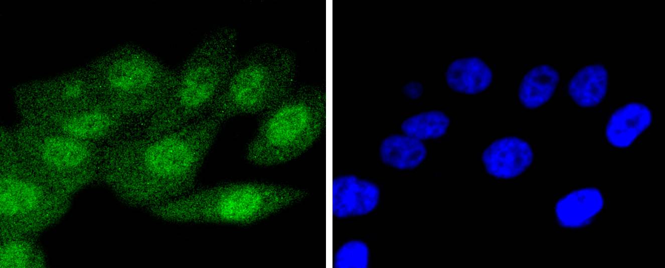 p16INK4A Rabbit mAb