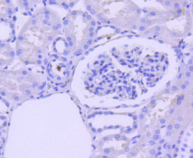 active+pro Caspase 3 Rabbit mAb