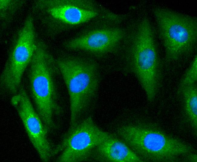 Myosin light chain kinase Rabbit mAb