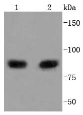 PI 3 Kinase p85 alpha Rabbit mAb