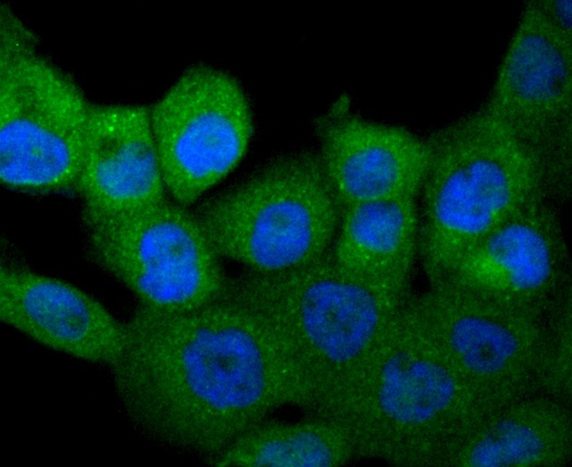 MCSF Rabbit mAb