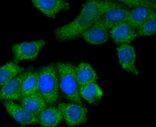 MCSF Rabbit mAb