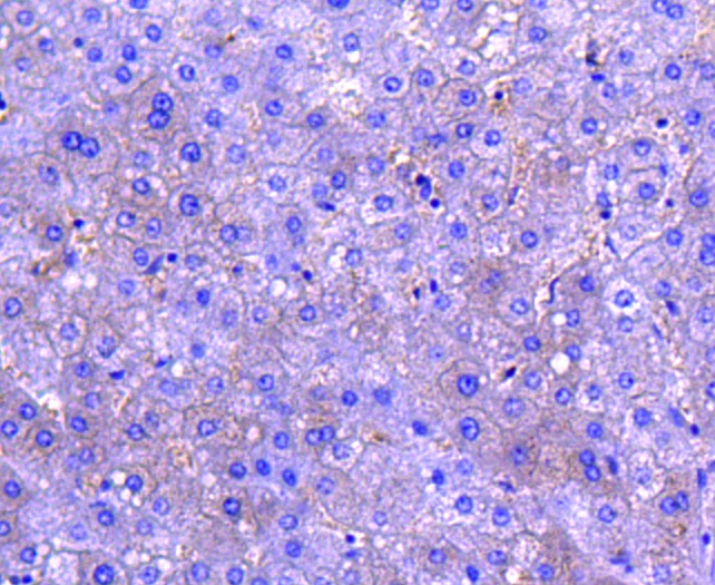 MCSF Rabbit mAb