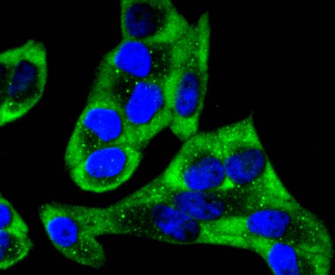 YB1 Rabbit mAb