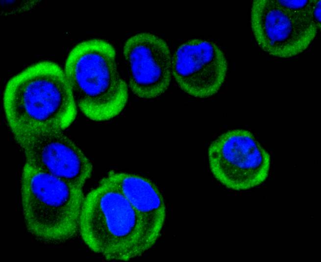 YB1 Rabbit mAb