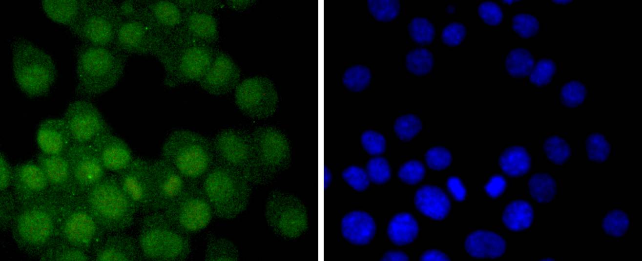 Androgen receptor Rabbit mAb