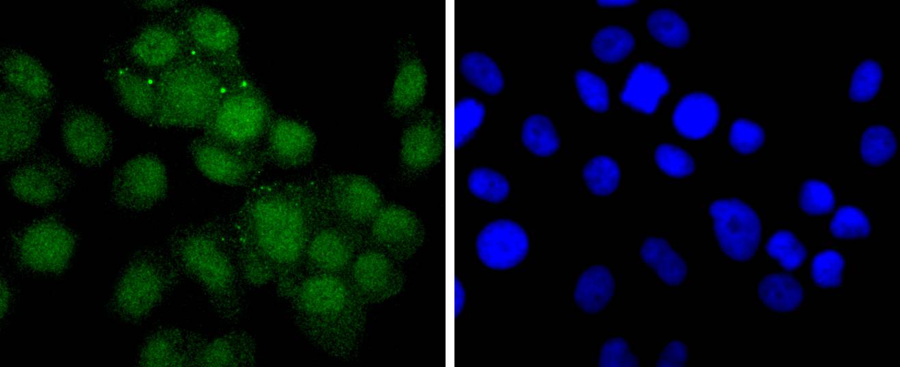 Androgen receptor Rabbit mAb