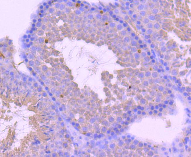 Androgen receptor Rabbit mAb