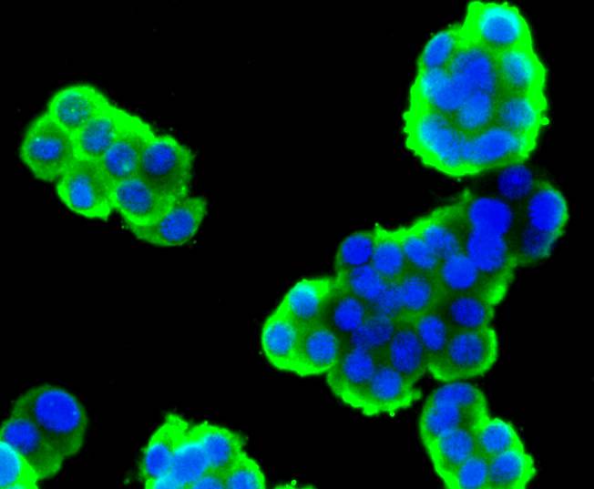 Stathmin 1 Rabbit mAb