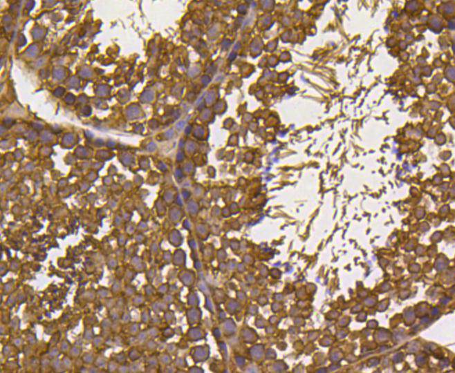 Ubiquitin Rabbit mAb