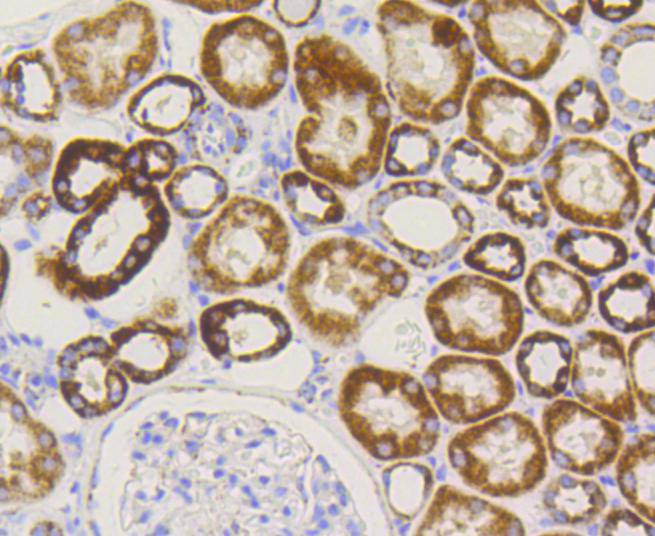 TOMM20 Rabbit mAb