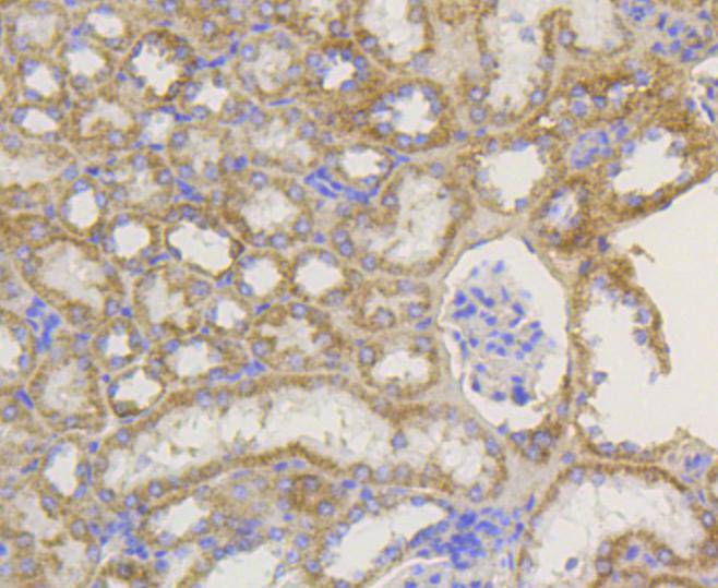 TOMM20 Rabbit mAb