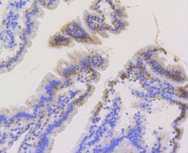 TOMM20 Rabbit mAb