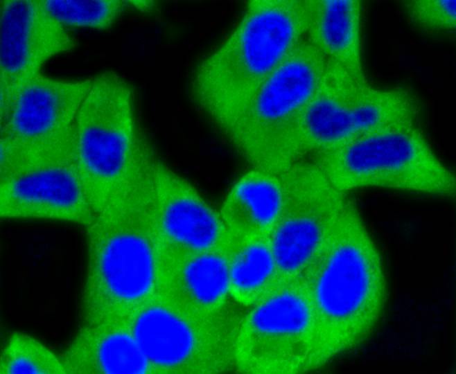 Hexokinase 1 Rabbit mAb