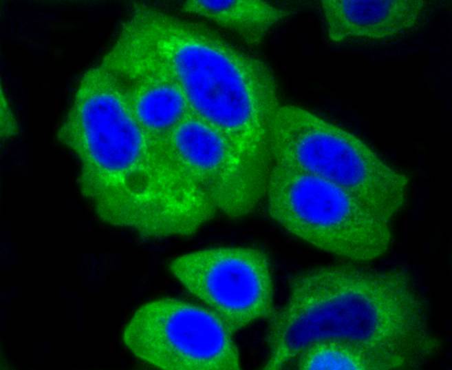 Hexokinase 1 Rabbit mAb