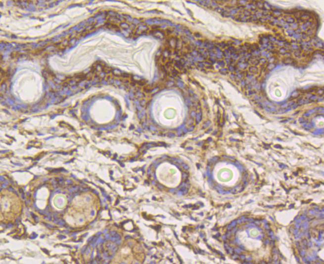 Hexokinase 1 Rabbit mAb