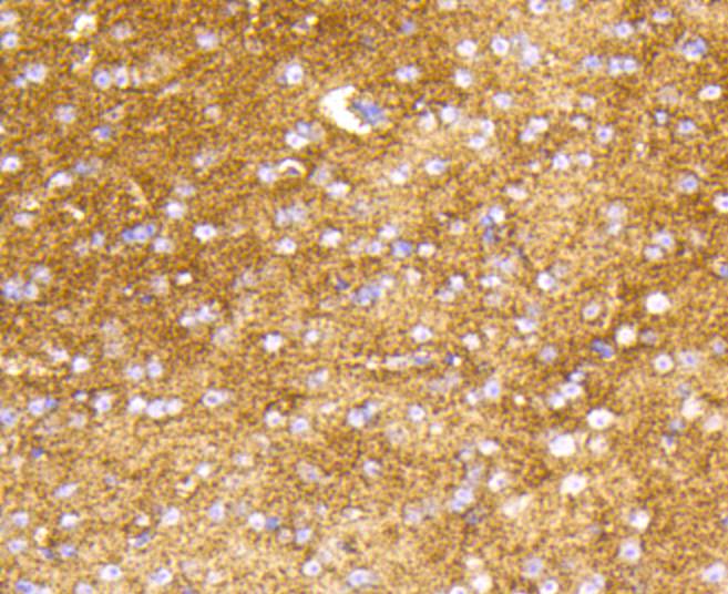 Hexokinase 1 Rabbit mAb