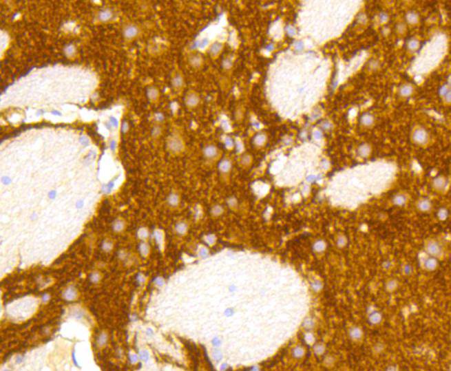 Metabotropic glutamate receptor 5 Rabbit mAb