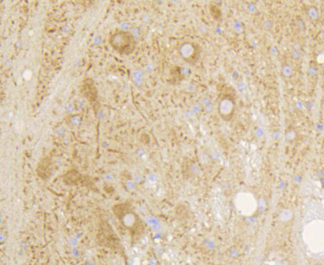 Metabotropic glutamate receptor 5 Rabbit mAb