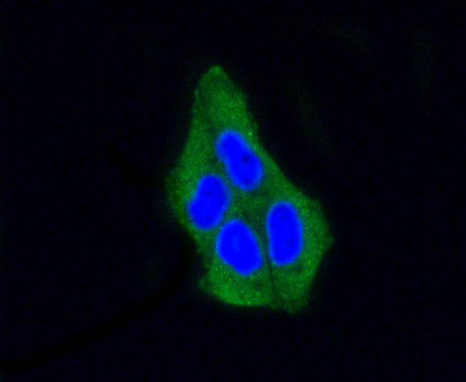 beta Arrestin 1 Rabbit mAb