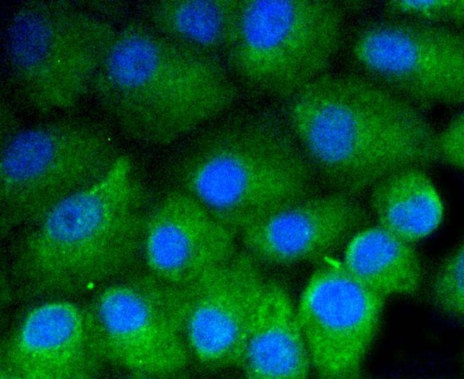 Vitronectin Rabbit mAb