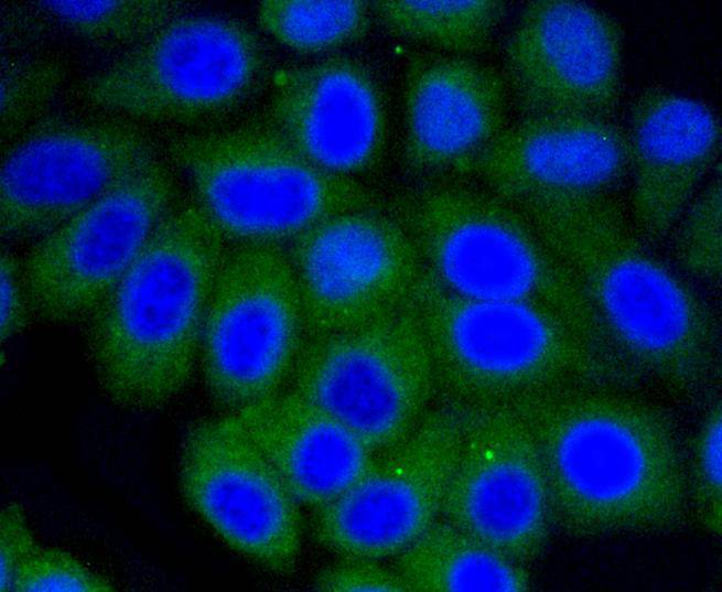 Vitronectin Rabbit mAb