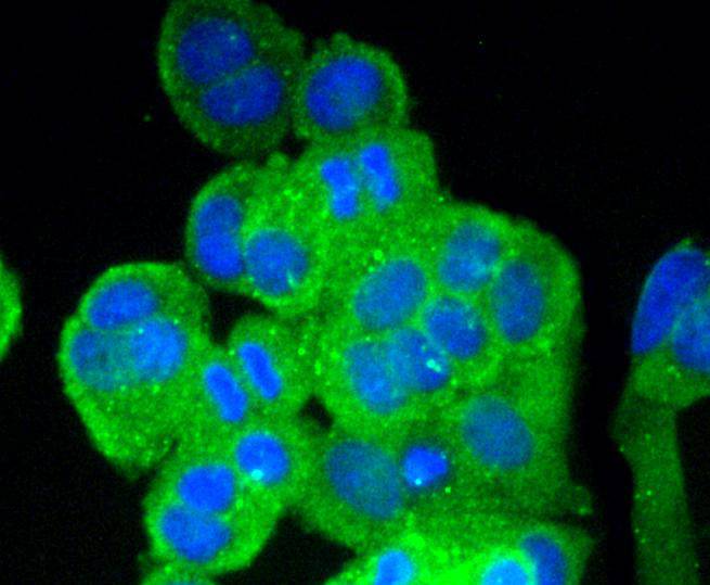 Vitronectin Rabbit mAb