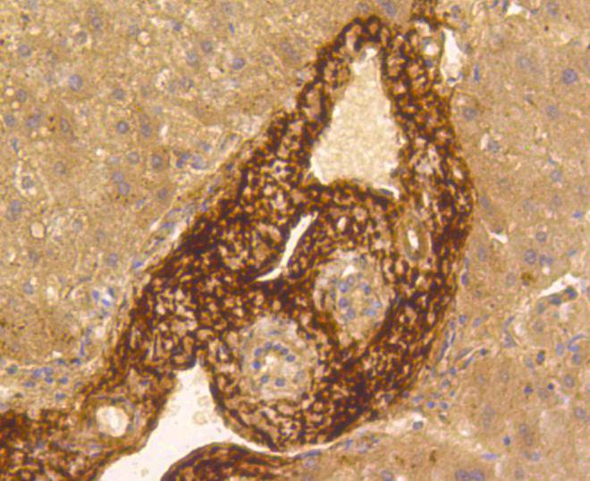 Vitronectin Rabbit mAb