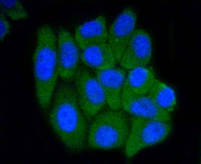 PRMT5 Rabbit mAb