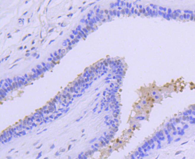 PRMT5 Rabbit mAb