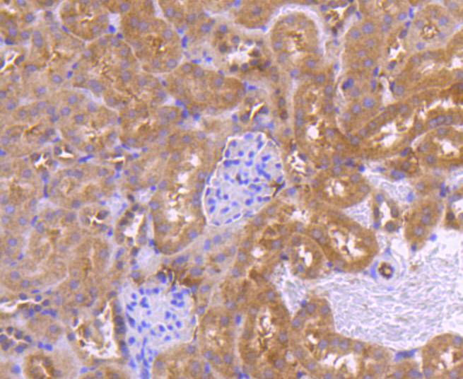 PRMT5 Rabbit mAb