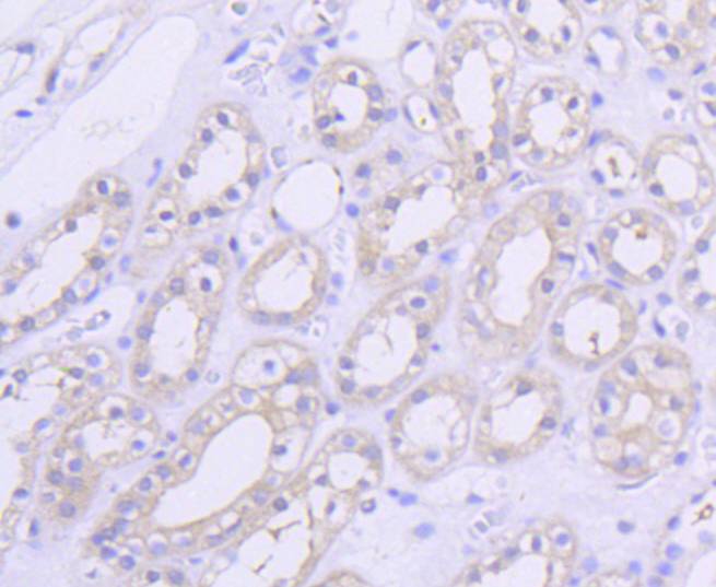 AKT1 Rabbit mAb