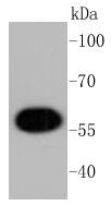 AKT1 Rabbit mAb
