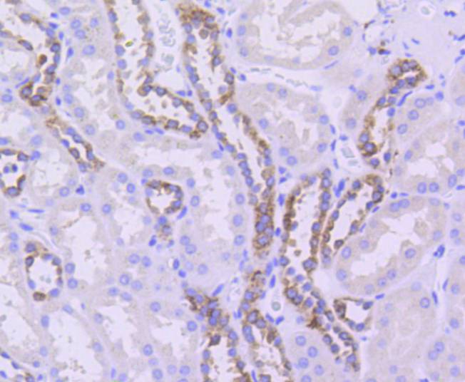 beta Ⅱ Tubulin Rabbit mAb
