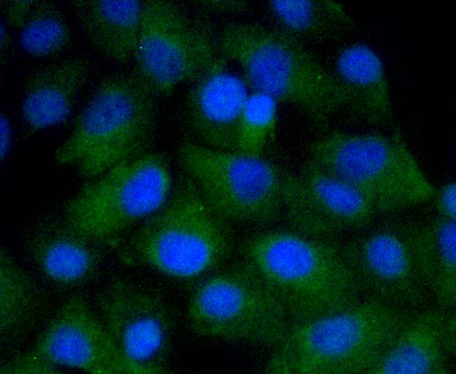 CD4 Rabbit mAb