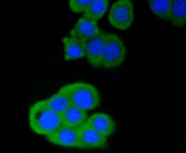 CD4 Rabbit mAb