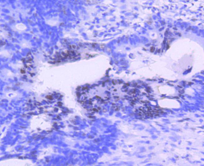 PIM1 Rabbit mAb