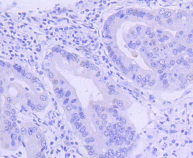 PIM1 Rabbit mAb