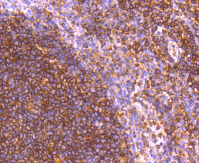 GRK2 Rabbit mAb