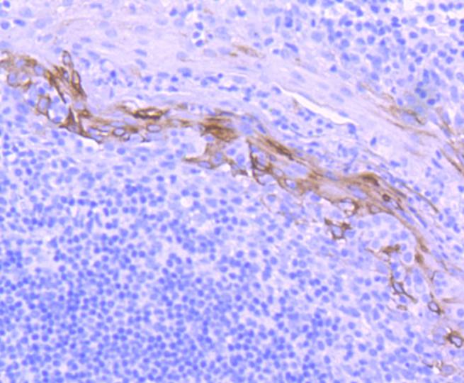 Cytokeratin 10 Rabbit mAb