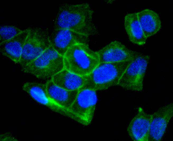 Sodium Potassium ATPase Rabbit mAb