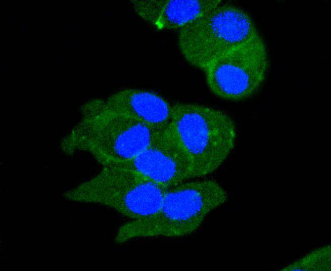 Sodium Potassium ATPase Rabbit mAb