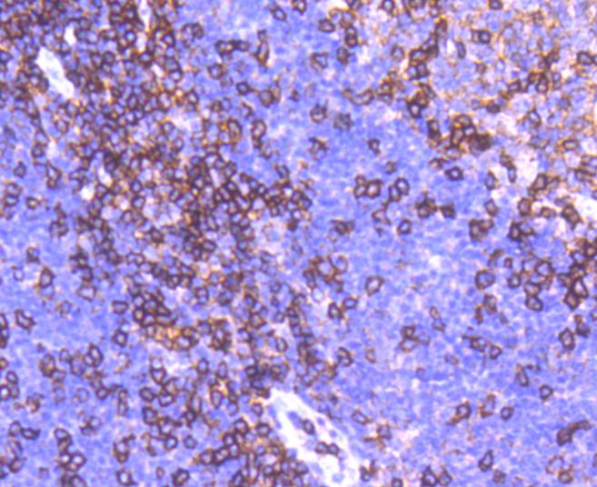 CD11a Rabbit mAb