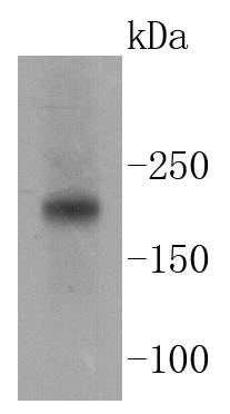 Tuberin Rabbit mAb